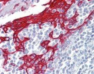 Anti-Cytokeratin 13 antibody, C-term used in IHC (Paraffin sections) (IHC-P). GTX88529