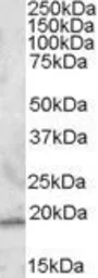 Anti-RGS13 antibody, N-term used in Western Blot (WB). GTX88537