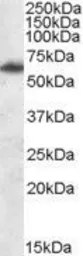 Anti-FTO antibody, Internal used in Western Blot (WB). GTX88551