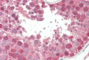 Anti-COG7 antibody, Internal used in IHC (Paraffin sections) (IHC-P). GTX88563