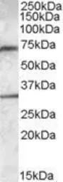 Anti-Endothelial Lipase / LIPG antibody, Internal used in Western Blot (WB). GTX88568