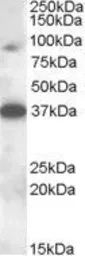 Anti-MARCH10 antibody, Internal used in Western Blot (WB). GTX88596
