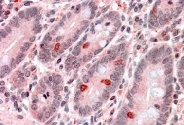 Anti-GNAT3 antibody, Internal used in IHC (Paraffin sections) (IHC-P). GTX88624