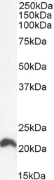 Anti-N-RAS antibody used in Western Blot (WB). GTX88676