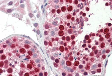 Anti-ABCA9 antibody, Internal used in IHC (Paraffin sections) (IHC-P). GTX88709