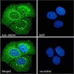 Anti-ABCA4 antibody, C-term used in Immunocytochemistry/ Immunofluorescence (ICC/IF). GTX88710