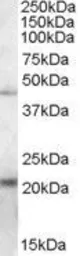 Anti-TXNDC4 antibody, Internal used in Western Blot (WB). GTX88718