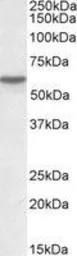 Anti-Vitamin D Binding Protein antibody, Internal used in Western Blot (WB). GTX88762