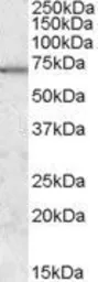 Anti-MARK2 antibody, Internal used in Western Blot (WB). GTX88790