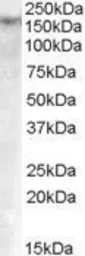 Anti-DNMT1 antibody, Internal used in Western Blot (WB). GTX88801