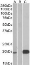 Anti-Urocortin 3 antibody, Internal used in Western Blot (WB). GTX88824
