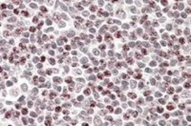 Anti-APOBEC3A antibody, Internal used in IHC (Paraffin sections) (IHC-P). GTX88838
