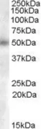 Anti-GCNT3 (aa 273 to 284) antibody, Internal used in Western Blot (WB). GTX88861