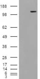 Anti-MAN2A1 antibody, Internal used in Western Blot (WB). GTX88874