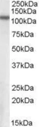 Anti-NPEPPS antibody, Internal used in Western Blot (WB). GTX88877