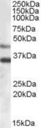 Anti-ARSB antibody, Internal used in Western Blot (WB). GTX88904