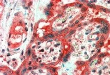 Anti-FAIM1 antibody, Internal used in IHC (Paraffin sections) (IHC-P). GTX88911