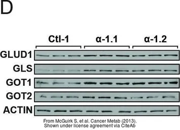 Anti-GOT2 (aa 360 to 373) antibody, Internal used in Western Blot (WB). GTX88925