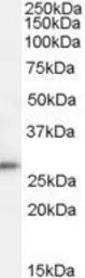 Anti-TPD52 antibody, C-term used in Western Blot (WB). GTX88974