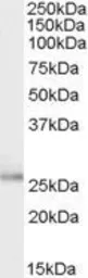 Anti-TPD52L1 antibody, Internal used in Western Blot (WB). GTX88976