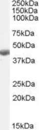 Anti-BHMT antibody, C-term used in Western Blot (WB). GTX88988