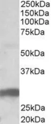 Anti-B7-H4 antibody, Internal used in Western Blot (WB). GTX88996
