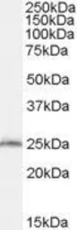 Anti-SAR1B antibody, Internal used in Western Blot (WB). GTX88997