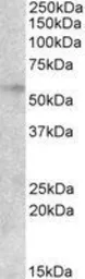 Anti-EGR2 antibody, Internal used in Western Blot (WB). GTX88998