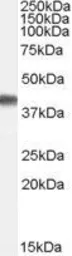 Anti-Cyclophilin 40 antibody, Internal used in Western Blot (WB). GTX89009