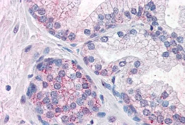 Anti-PDE11A antibody, Internal used in IHC (Paraffin sections) (IHC-P). GTX89018