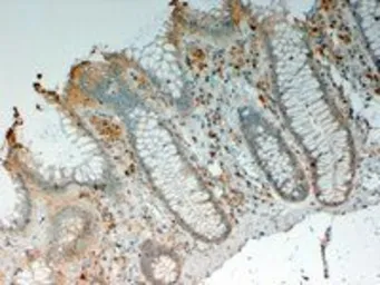 Anti-IL12B / IL12 p40 antibody, Internal used in IHC (Paraffin sections) (IHC-P). GTX89024