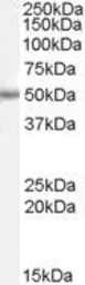 Anti-PAX6 antibody, Internal used in Western Blot (WB). GTX89029