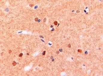 Anti-CD11b antibody, Internal used in IHC (Paraffin sections) (IHC-P). GTX89035