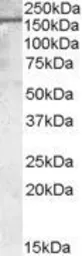 Anti-PODXL antibody, C-term used in Western Blot (WB). GTX89038