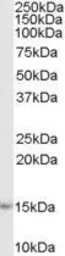 Anti-Iba1 (isoforms 1 + 3) antibody, C-term used in Western Blot (WB). GTX89048