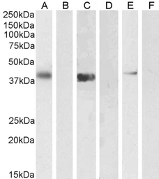 Anti-PTF1A antibody, Internal used in Western Blot (WB). GTX89052