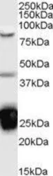Anti-TIA1 antibody, Internal used in Western Blot (WB). GTX89059