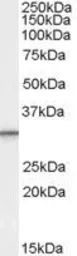 Anti-PSME1 (isoform 1) antibody, C-term used in Western Blot (WB). GTX89093