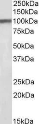 Anti-HAP1 antibody, C-term used in Western Blot (WB). GTX89095