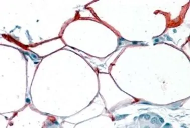 Anti-KIAA1881 antibody, Internal used in IHC (Paraffin sections) (IHC-P). GTX89103