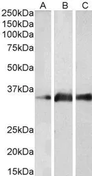 Anti-Kallikrein 5 antibody, Internal used in Western Blot (WB). GTX89113