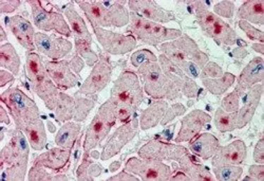 Anti-ATGL antibody, Internal used in IHC (Paraffin sections) (IHC-P). GTX89133