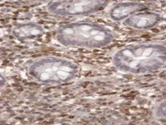 Anti-S100A4 antibody, C-term used in IHC (Paraffin sections) (IHC-P). GTX89197
