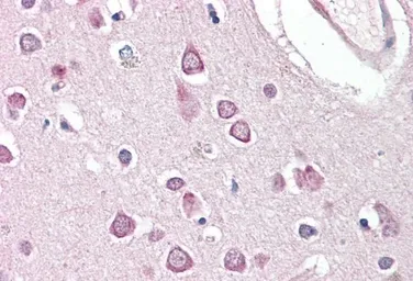 Anti-HAP1 antibody, Internal used in IHC (Paraffin sections) (IHC-P). GTX89202