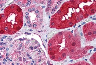 Anti-RNF213 antibody, Internal used in IHC (Paraffin sections) (IHC-P). GTX89208