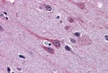 Anti-GBX2 antibody, Internal used in IHC (Paraffin sections) (IHC-P). GTX89212