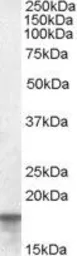 Anti-Anterior Gradient 2 antibody, Internal used in Western Blot (WB). GTX89217
