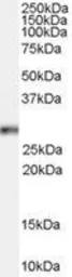 Anti-HOXB13 antibody, C-term used in Western Blot (WB). GTX89223