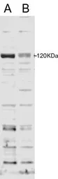 Anti-SBP2 antibody, Internal used in Western Blot (WB). GTX89253