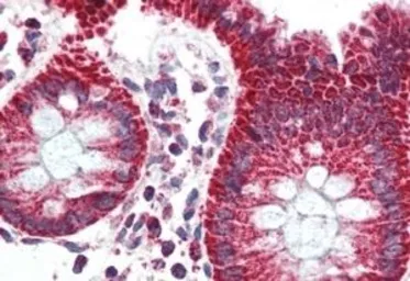 Anti-PBR antibody, C-term used in IHC (Paraffin sections) (IHC-P). GTX89258